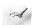 collodel piede.TIF (12315 byte)