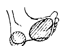 ttt